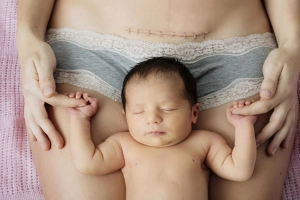Sau sinh mổ bao lâu thì làm việc nặng được?