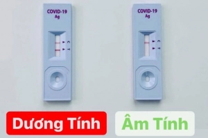 Sau tiếp xúc F0 bao lâu test COVID-19 mới chính xác?