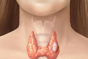 Siêu âm tuyến giáp có nang ở thùy eo có nguy hiểm không?