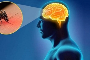 Tác nhân gây ra bệnh viêm não là gì?