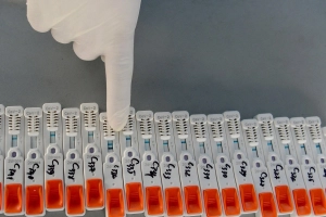 Test nhanh dương tính test PCR âm tính, hoặc ngược lại, phải làm thế nào?