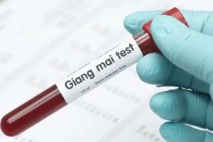 Test nhanh giang mai có chính xác?