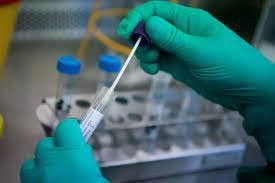 Test PCR sau bao lâu có kết quả?