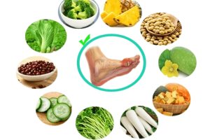 Tham khảo bữa sáng cho người bệnh Gout