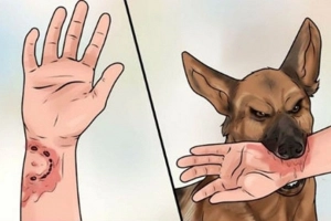 Thời gian ủ bệnh của bệnh dại như thế nào?