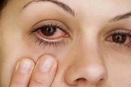 Thường xuyên đau ngứa mắt kèm đỏ mắt dấu hiệu bệnh gì?