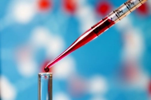 Tỉ lệ Albumin / Globulin (A/G) trong xét nghiệm nói lên điều gì?