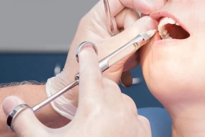 Tiêm thuốc tê khi nhổ răng có đau không?