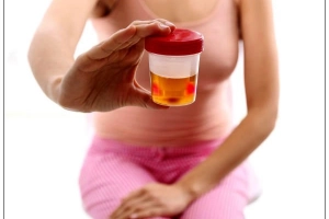 Tiểu ra máu kèm buốt khi tiểu điều trị thế nào?