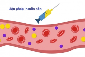 Tìm hiểu liệu pháp insulin nền