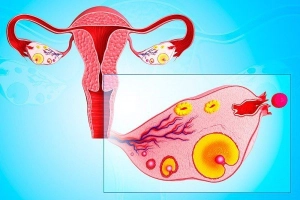 Tìm hiểu về các dị dạng sinh dục nữ