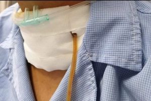 Tìm hiểu về rò bạch huyết
