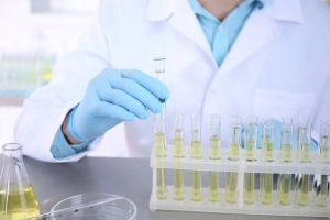 Tìm hiểu xét nghiệm cấy nước tiểu