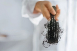 Tóc gãy rụng nhiều gây hói điều trị thế nào?