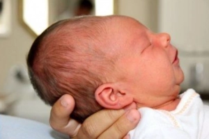 Trẻ sơ sinh đầu dài và bẹp