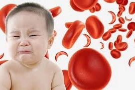 Trẻ sơ sinh thiếu máu do thiếu sắt