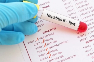 Tư vấn kết quả xét nghiệm HBV - DNA