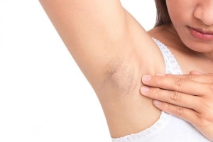 Tuyệt chiêu hết thâm nách từ nguyên liệu nhà bếp
