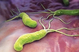 Vai trò bảo vệ của vi khuẩn H.Pylori