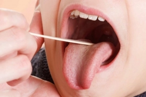 Vết cắt amidan chuyển màu đỏ có nguy hiểm không?