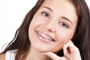 Vì sao bạn bị hóp má và thái dương khi niềng răng?