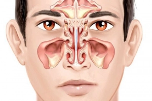 Vì sao viêm xoang gây mất khứu giác?