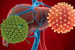 Viêm gan cấp tính và nhiễm virus Adenovirus ở trẻ em