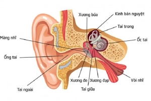 Viêm ống tai kèm sưng, ù tai có sao không?