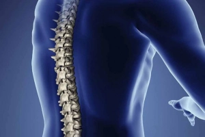 Viêm tủy ngang cấp: Những điều cần biết