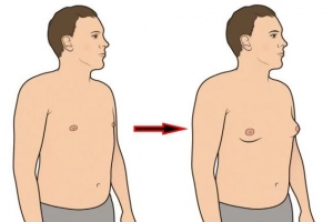 Vú to ở nam giới có nguy hiểm không?