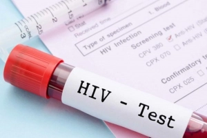 Xét nghiệm HIV âm tính là gì?