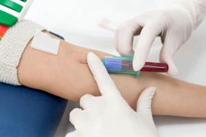 Xét nghiệm nội tiết tố Luteinizing (LH) nhằm mục đích gì?