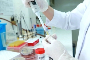 Xét nghiệm nuôi cấy đờm định kỳ