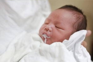 Xử lý khi trẻ bị trớ xộc lên mũi