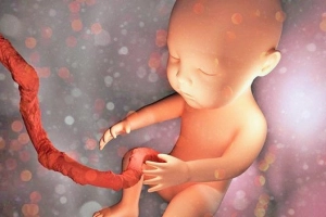Xử trí sa dây rốn ở thai nhi khi đã vỡ ối