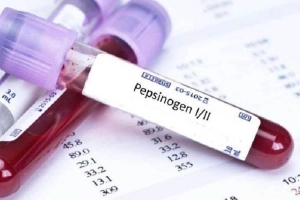 Ý nghĩa các chỉ số xét nghiệm Pepsinogen là gì?