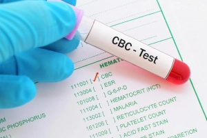 Ý nghĩa lâm sàng xét nghiệm máu toàn bộ (CBC)