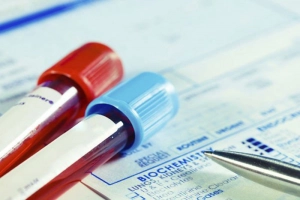 Ý nghĩa xét nghiệm SCC chẩn đoán ung thư biểu mô tế bào vảy