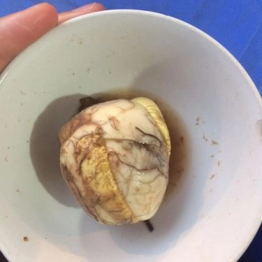 Món ăn- Quán Ăn Gà Tần, Xôi, Cháo, Bánh Mì - Tôn Thất Tùng