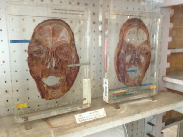 Ảnh: Medical Museion / Flickr Ảnh: Medical Museion / Flickr