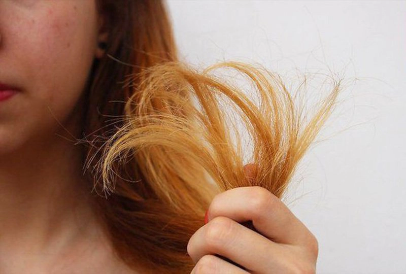 Tóc gãy rụng và khô xơ là một trong các dấu hiệu của tình trạng ăn uống thiếu chất
