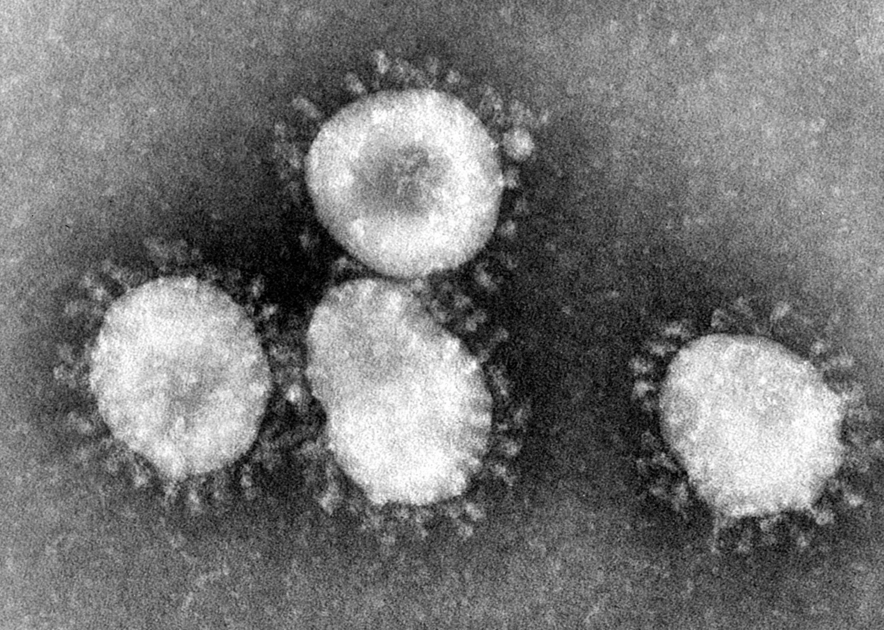 Corona virus SARS