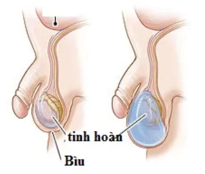 một túi mỏng giữ tinh hoàn