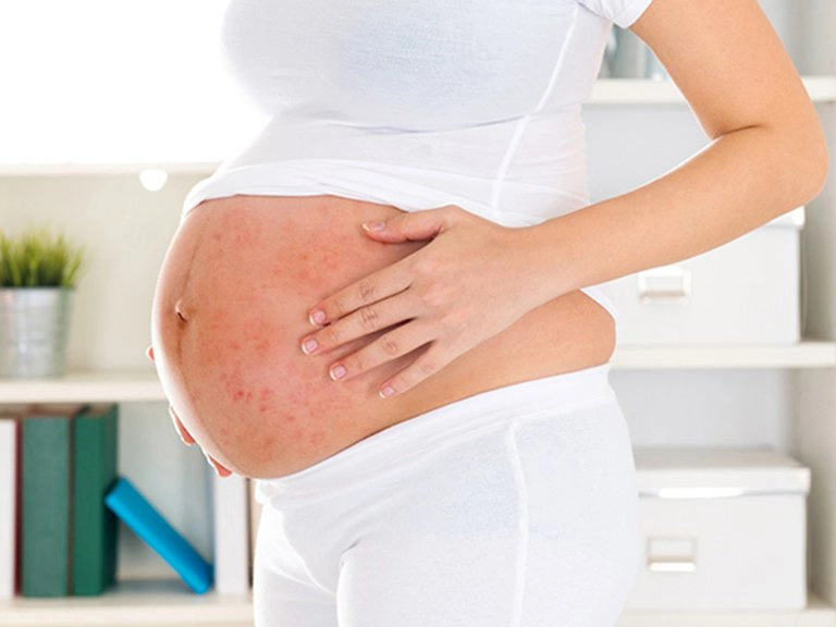 Mẹ bầu bị dị ứng thực phẩm phải làm sao?