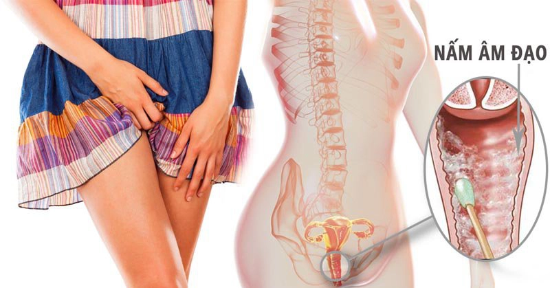 Bị viêm vùng kín có quan hệ được không
