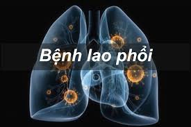 Hậu quả lao phổi