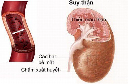 Các câu hỏi thường gặp về xét nghiệm creatinin trong máu