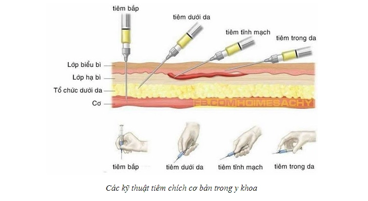 Các kĩ thuật tiêm