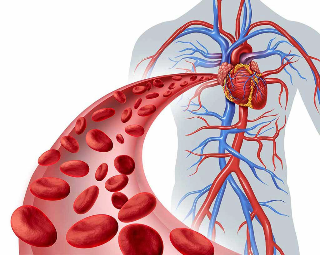 các nguyên nhân gây đột quỵ ở người trẻ