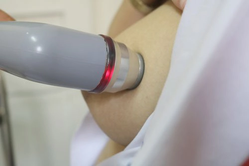 nguyên nhân tắc tia sữa